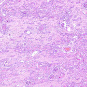 Microscope slide